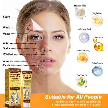 Raindew™ 7-Day Rapid Skin Repair Cream Approved by dermatologists (BfArM recommended)𝐒 𝐃𝐞𝐫𝐦𝐚𝐭𝐨𝐥𝐨𝐠𝐢𝐬𝐭 𝐀𝐩𝐩𝐫𝐨𝐯𝐞𝐝(💞💞𝐀𝐀𝐃 𝐑𝐄𝐂𝐎𝐌𝐌𝐄𝐍𝐃𝐒)