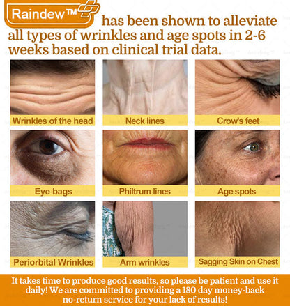 Raindew™ 7-Day Rapid Skin Repair Cream Approved by dermatologists (BfArM recommended)𝐒 𝐃𝐞𝐫𝐦𝐚𝐭𝐨𝐥𝐨𝐠𝐢𝐬𝐭 𝐀𝐩𝐩𝐫𝐨𝐯𝐞𝐝(💞💞𝐀𝐀𝐃 𝐑𝐄𝐂𝐎𝐌𝐌𝐄𝐍𝐃𝐒)