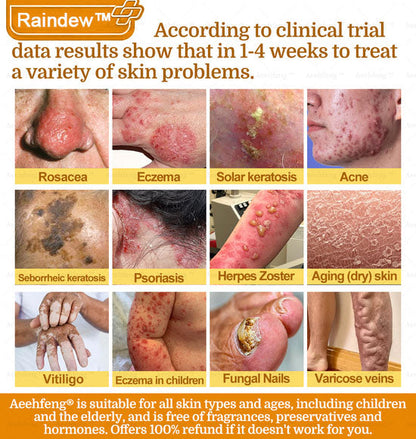 Raindew™ 7-Day Rapid Skin Repair Cream Approved by dermatologists (BfArM recommended)𝐒 𝐃𝐞𝐫𝐦𝐚𝐭𝐨𝐥𝐨𝐠𝐢𝐬𝐭 𝐀𝐩𝐩𝐫𝐨𝐯𝐞𝐝(💞💞𝐀𝐀𝐃 𝐑𝐄𝐂𝐎𝐌𝐌𝐄𝐍𝐃𝐒)