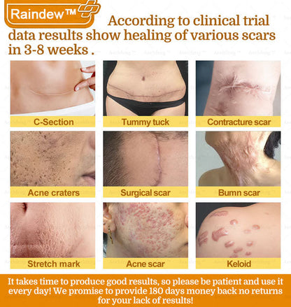 Raindew™ 7-Day Rapid Skin Repair Cream Approved by dermatologists (BfArM recommended)𝐒 𝐃𝐞𝐫𝐦𝐚𝐭𝐨𝐥𝐨𝐠𝐢𝐬𝐭 𝐀𝐩𝐩𝐫𝐨𝐯𝐞𝐝(💞💞𝐀𝐀𝐃 𝐑𝐄𝐂𝐎𝐌𝐌𝐄𝐍𝐃𝐒)