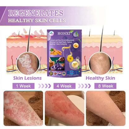 HONXI™ Turmeric and Emu Oil Anti-Inflammatory Slimming Foot Soak Pearls - Natural Soothing + Body Contouring
