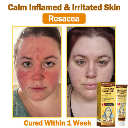 Raindew™ 7-Day Rapid Skin Repair Cream Approved by dermatologists (BfArM recommended)𝐒 𝐃𝐞𝐫𝐦𝐚𝐭𝐨𝐥𝐨𝐠𝐢𝐬𝐭 𝐀𝐩𝐩𝐫𝐨𝐯𝐞𝐝(💞💞𝐀𝐀𝐃 𝐑𝐄𝐂𝐎𝐌𝐌𝐄𝐍𝐃𝐒)
