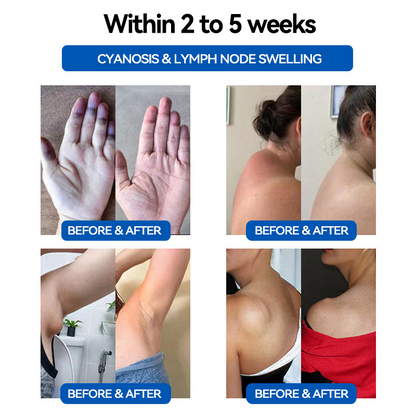 CZTICLE™ Non-Invasive Continuous Glucose Monitoring Detox Wristband